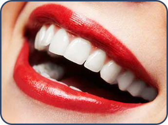 Woman Smiling With Dental Veneers in Orange Park, FL